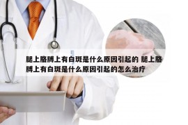 腿上胳膊上有白斑是什么原因引起的 腿上胳膊上有白斑是什么原因引起的怎么治疗