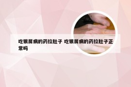 吃银屑病的药拉肚子 吃银屑病的药拉肚子正常吗