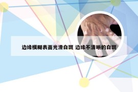 边缘模糊表面光滑白斑 边缘不清晰的白斑