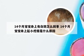 14个月宝宝身上有白斑怎么回事 14个月宝宝身上起小疙瘩是什么原因