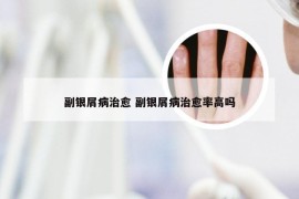 副银屑病治愈 副银屑病治愈率高吗