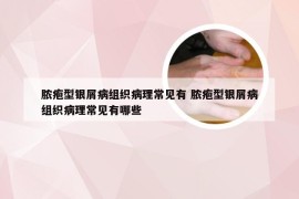 脓疱型银屑病组织病理常见有 脓疱型银屑病组织病理常见有哪些