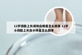 12岁孩脸上长成块白斑是怎么回事 12岁小孩脸上长白小块是怎么回事