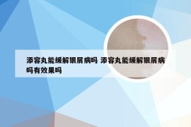 添容丸能缓解银屑病吗 添容丸能缓解银屑病吗有效果吗