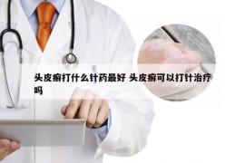 头皮癣打什么针药最好 头皮癣可以打针治疗吗