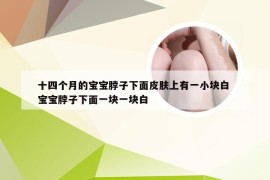 十四个月的宝宝脖子下面皮肤上有一小块白 宝宝脖子下面一块一块白