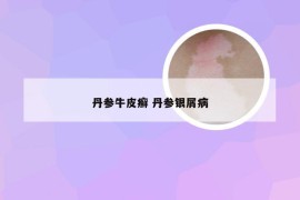 丹参牛皮癣 丹参银屑病