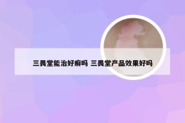 三畏堂能治好癣吗 三畏堂产品效果好吗