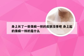 身上长了一些像癣一样的皮肤没事吧 身上起的像癣一样的是什么