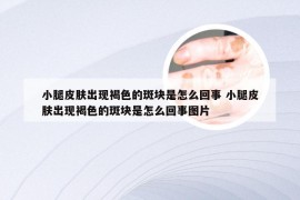 小腿皮肤出现褐色的斑块是怎么回事 小腿皮肤出现褐色的斑块是怎么回事图片