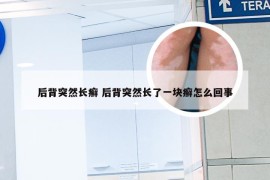 后背突然长癣 后背突然长了一块癣怎么回事