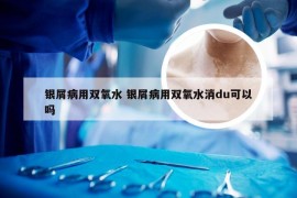 银屑病用双氧水 银屑病用双氧水消du可以吗