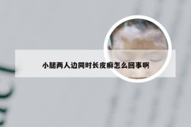 小腿两人边同时长皮癣怎么回事啊