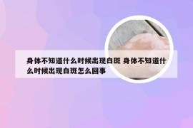 身体不知道什么时候出现白斑 身体不知道什么时候出现白斑怎么回事