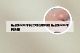 拓咨依奇珠单抗注射液银屑病 拓咨依奇珠单抗价格