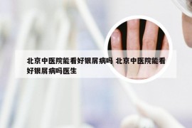 北京中医院能看好银屑病吗 北京中医院能看好银屑病吗医生