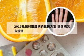 2015社保对银屑病的救援方案 银屑病怎么报销