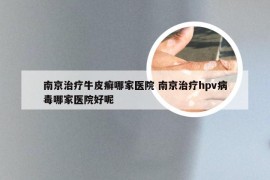 南京治疗牛皮癣哪家医院 南京治疗hpv病毒哪家医院好呢