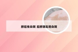 脖后有白斑 后脖颈出现白斑