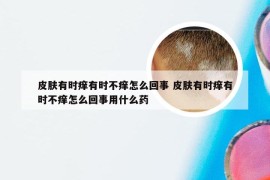 皮肤有时痒有时不痒怎么回事 皮肤有时痒有时不痒怎么回事用什么药