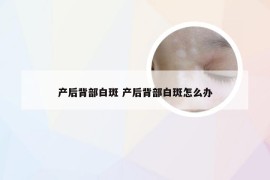 产后背部白斑 产后背部白斑怎么办