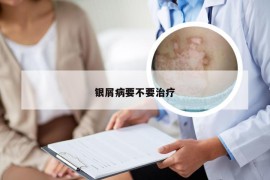 银屑病要不要治疗