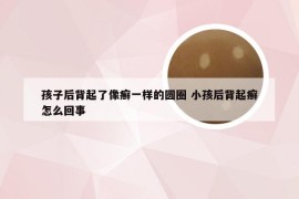 孩子后背起了像癣一样的圆圈 小孩后背起癣怎么回事