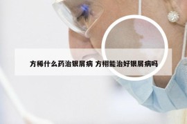 方稀什么药治银屑病 方栩能治好银屑病吗