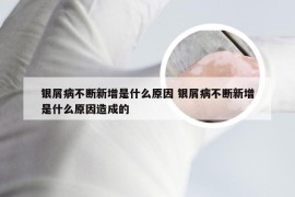 银屑病不断新增是什么原因 银屑病不断新增是什么原因造成的