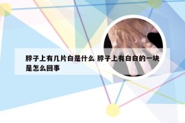 脖子上有几片白是什么 脖子上有白白的一块是怎么回事