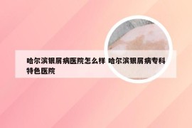 哈尔滨银屑病医院怎么样 哈尔滨银屑病专科特色医院