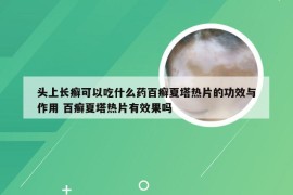 头上长癣可以吃什么药百癣夏塔热片的功效与作用 百癣夏塔热片有效果吗