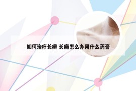 如何治疗长癣 长癣怎么办用什么药膏