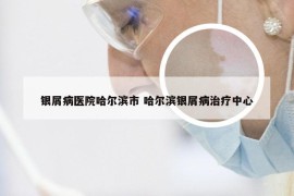 银屑病医院哈尔滨市 哈尔滨银屑病治疗中心