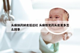 头癣抹药掉皮后还红 头癣擦完药头皮更多怎么回事