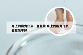 身上的癣为什么一直复发 身上的癣为什么一直复发不好