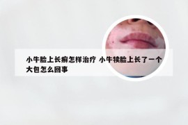 小牛脸上长癣怎样治疗 小牛犊脸上长了一个大包怎么回事