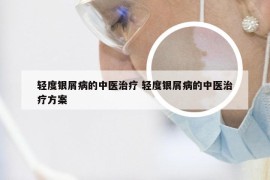 轻度银屑病的中医治疗 轻度银屑病的中医治疗方案