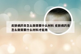 皮肤病药膏怎么做需要什么材料 皮肤病药膏怎么做需要什么材料才能用