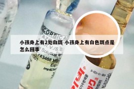 小孩身上有2处白斑 小孩身上有白色斑点是怎么回事