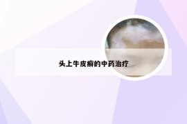 头上牛皮癣的中药治疗