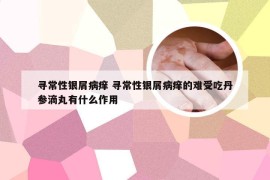 寻常性银屑病痒 寻常性银屑病痒的难受吃丹参滴丸有什么作用