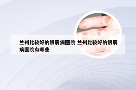 兰州比较好的银屑病医院 兰州比较好的银屑病医院有哪些