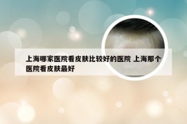 上海哪家医院看皮肤比较好的医院 上海那个医院看皮肤最好