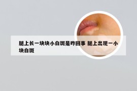 腿上长一块块小白斑是咋回事 腿上出现一小块白斑