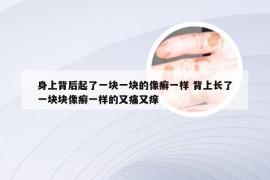 身上背后起了一块一块的像癣一样 背上长了一块块像癣一样的又痛又痒