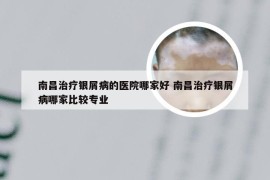 南昌治疗银屑病的医院哪家好 南昌治疗银屑病哪家比较专业