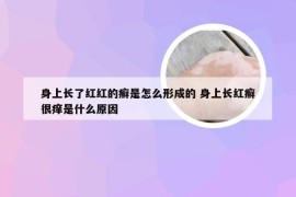 身上长了红红的癣是怎么形成的 身上长红癣很痒是什么原因