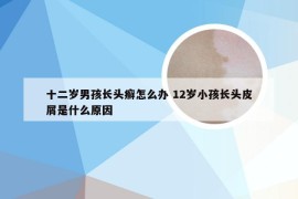 十二岁男孩长头癣怎么办 12岁小孩长头皮屑是什么原因