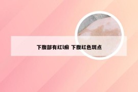 下腹部有红l癣 下腹红色斑点